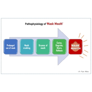 Patho-physiology-of-mask-mouth-.jpg