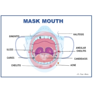 mask-mouth-image.jpg